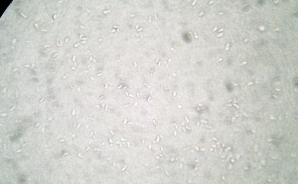 Forse lo so.... Byssomerulius corium? (B. corium)